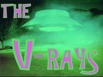 THE V RAYS