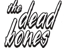 the dead bones