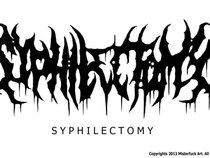 Syphilectomy(official)