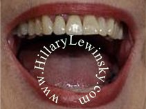 Hillary Lewinsky