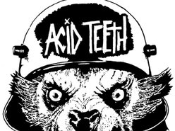 Image for Acid Teeth