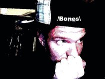 /Bones\
